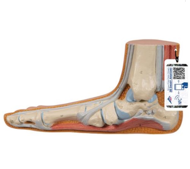 Model plochej nohy (pes planus)