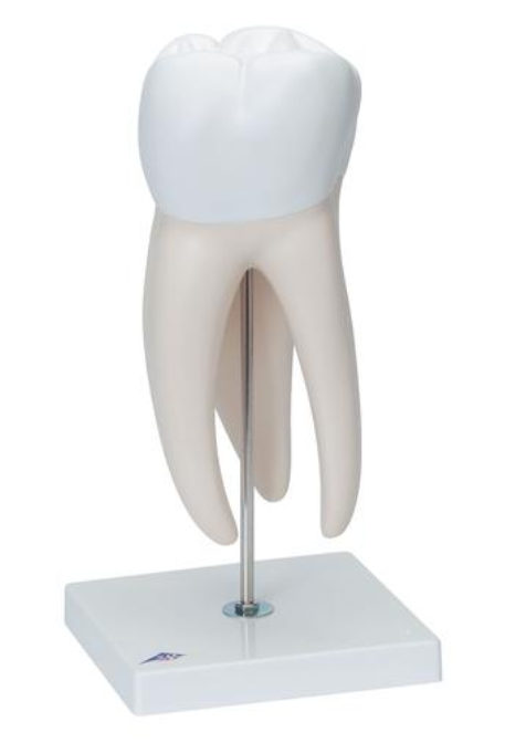 Veľká stolička s dentálnymi dutinami, 15-krát životná veľkosť, 6 dielov
