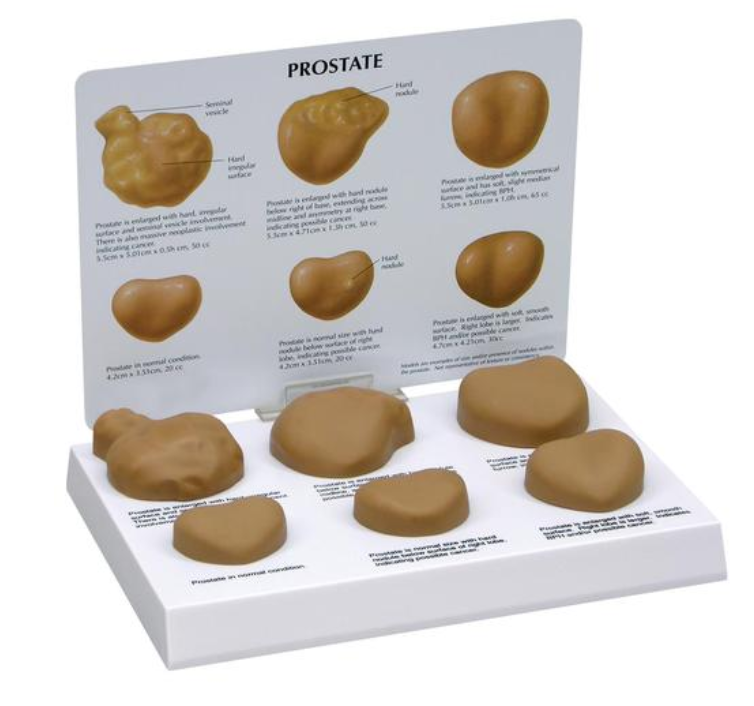 Model prostaty